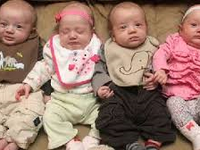 Quadruplets! (Comment Who)