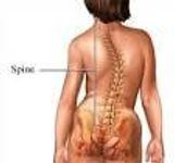 Living With Scoliosis