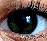 So I took a picture of my sister's eye...