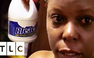 Addicted to Bathing In Bleach | My Strange Addiction