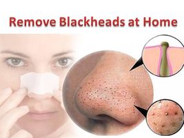 Blackheads Removing Mask