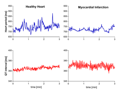 What is considered a healthy heart rate?