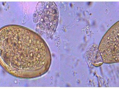 Qual a característica que permite identificar como sendo ovo de Fascíola Hepática?