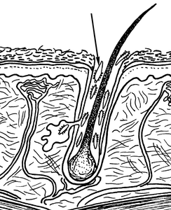 What contagious skin condition is caused by mites burrowing into the skin?