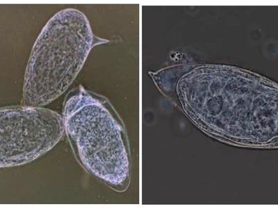 Qual a característica que permite identificar o Ovo como sendo de Schistosoma Mansoni?