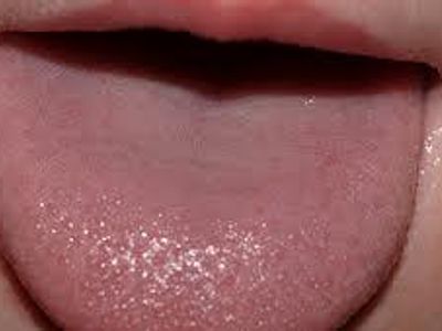 Your tongue has 700, 000 taste buds