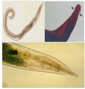 Quais as características que permites ver que o Parasita é Enterobius?