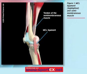 What basketball injury involves pain and inflammation in the tendons connecting the muscles to the shinbone?