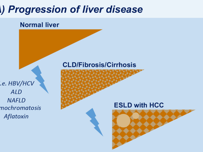 What is the name of the process by which the liver breaks down alcohol?