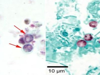 Qual a amostra usada para pesquisa de Cryptosporidium?