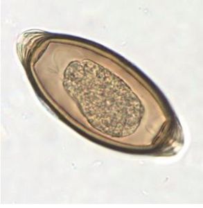 Qual a característica que permite identificar o ovo como sendo de Trichuris Trichiura?