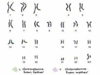 How many chromosomes are in a human somatic cell?