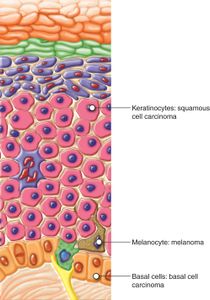 Which of the following is NOT a mode of bacterial reproduction?