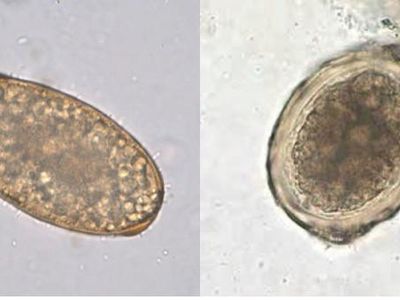 Diga qual o Ovo de Ascaris Lumbricoides Fertil e qual o Infertil?