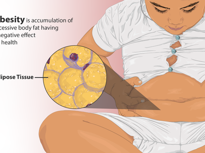 What is the term for excess fat accumulation in the abdominal area?