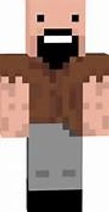 Who's skin is this?