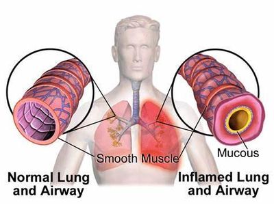 Which prescription drug is used to treat respiratory conditions such as asthma?