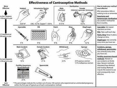 Which of the following is a common method of birth control for women?