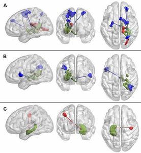 What brain structure can experience positive growth due to aerobic exercise?