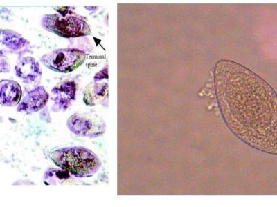 Qual a característica que permite identificar como sendo ovo de Schistosoma Haematobium?