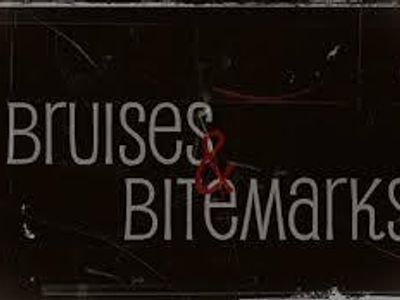 Bruises and Bitmarks