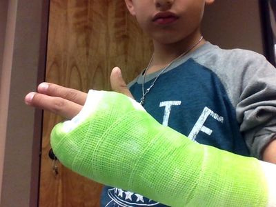 my brother broke his hand ;-;