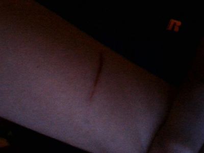 My Dog Did This To Me :(