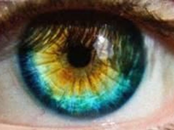 What is ur eye colour??