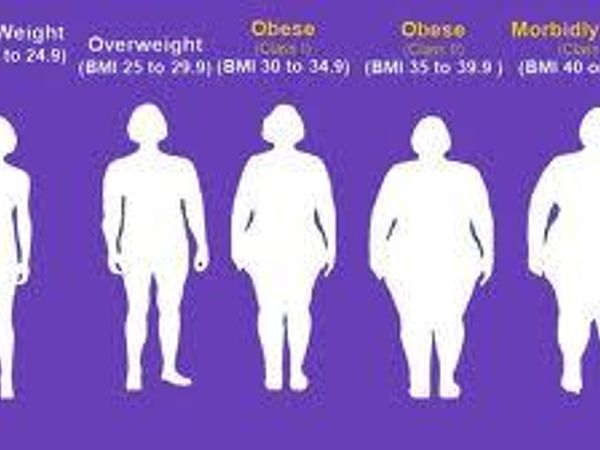 What is your Body Mass Index (bmi)?