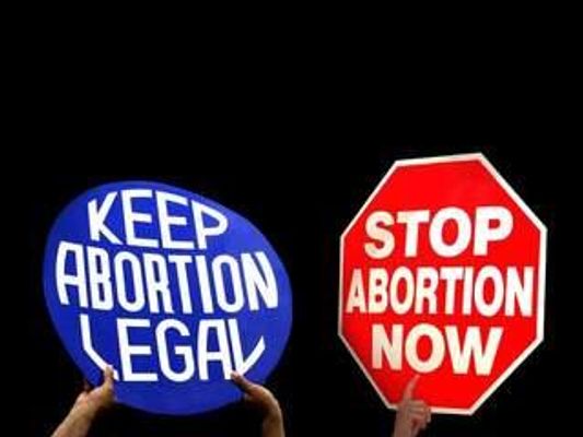 Do you think that abortion should be legal? Why or why not? Do you think that abortion should be legal? Why or why not? This is NOT to start drama or cause arguments; if you start being rude to people, I will either edit or delete your comments/answers. Thanks!