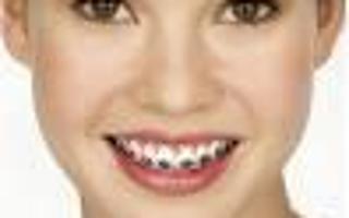 Are You Gonna Get Braces