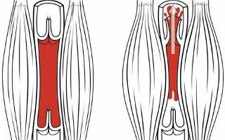 Pump Up Your Muscle Knowledge