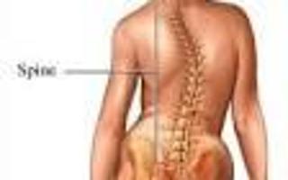 Living With Scoliosis