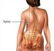 Living With Scoliosis