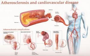 Easy Solutions To Prevent A Deficitary Blood Circulation | With Gloves