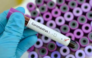 When and how do you think the Coronavirus pandemic will end?