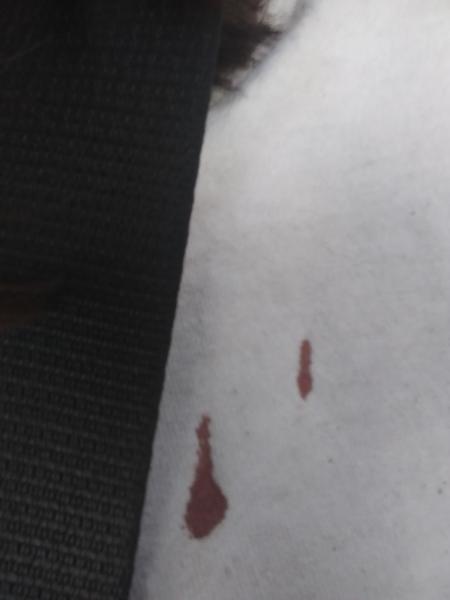 Blood on my damn white shirt