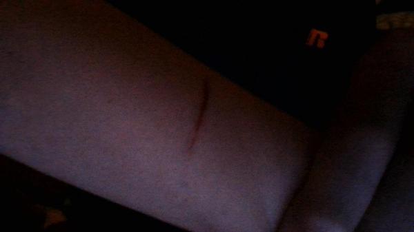 My Dog Did This To Me :(