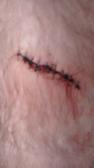 mah new stitches :3