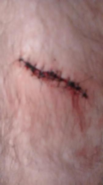 mah new stitches :3